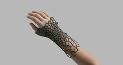 Hand_splint-formlabs-750 Hand_splint-formlabs-750