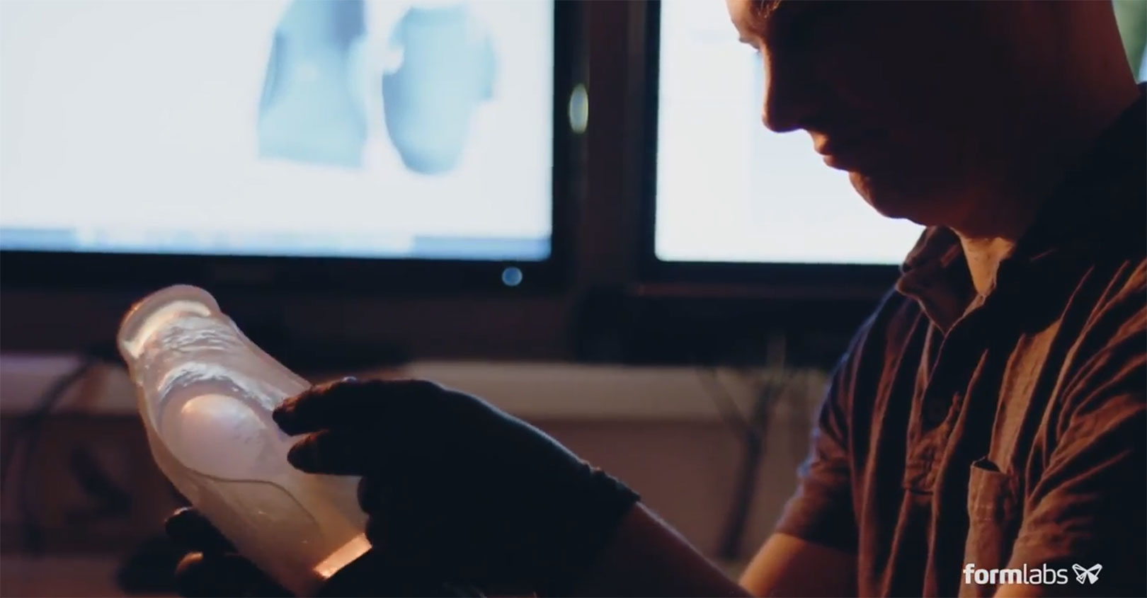 Matej inspecting orthoses