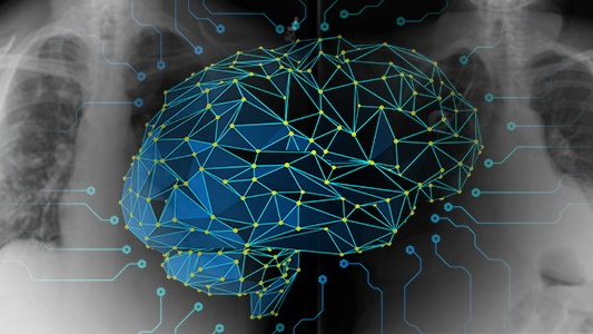 Cognex1 5f49215e1f80d