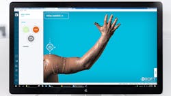 Techmed 3D's MSoft Software showing an arm scan. Techmed 3D's MSoft Software showing an arm scan.