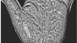 Optical scanning of hand for biomedical diagnosis Optical scanning of hand for biomedical diagnosis