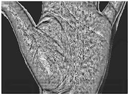 Optical scanning of hand for biomedical diagnosis Optical scanning of hand for biomedical diagnosis