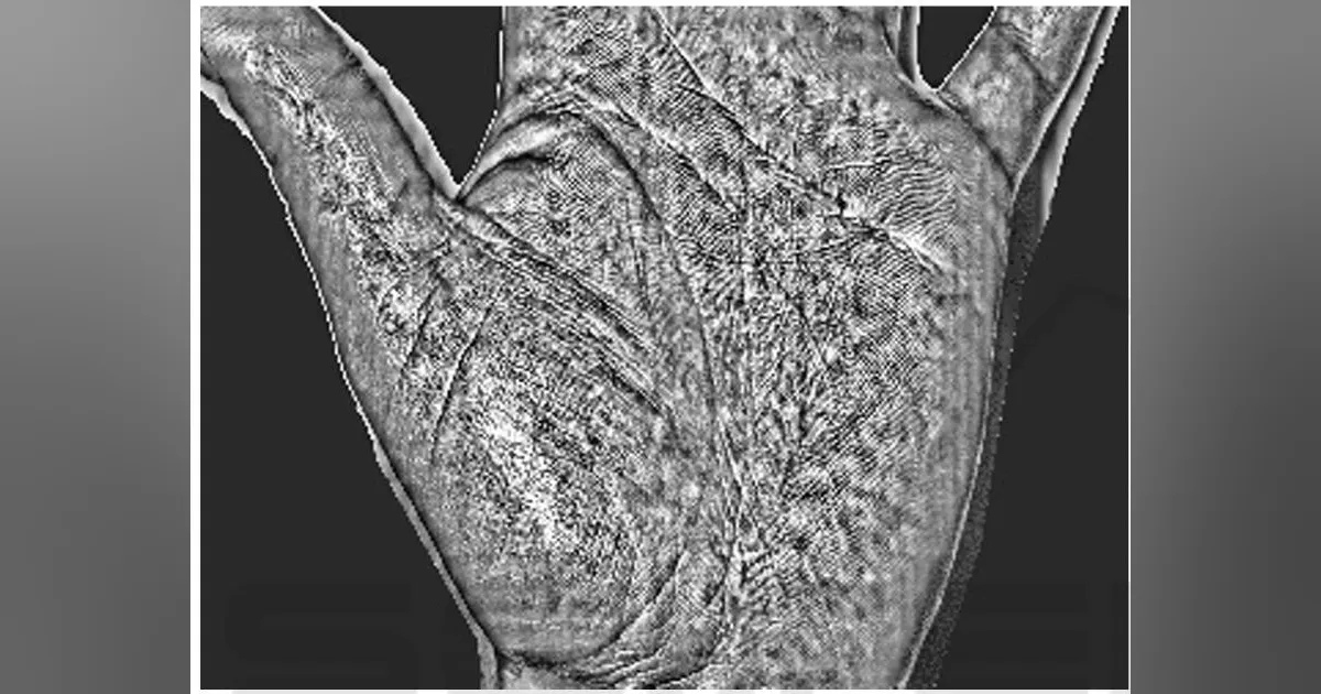 Optical Line Scan Experimental Optical Scanning Device for Biomedical Diagnosis Uses ...