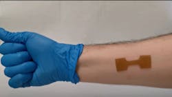 3 D Printed Adhesive Bandage With Drug Release For Burn Patients