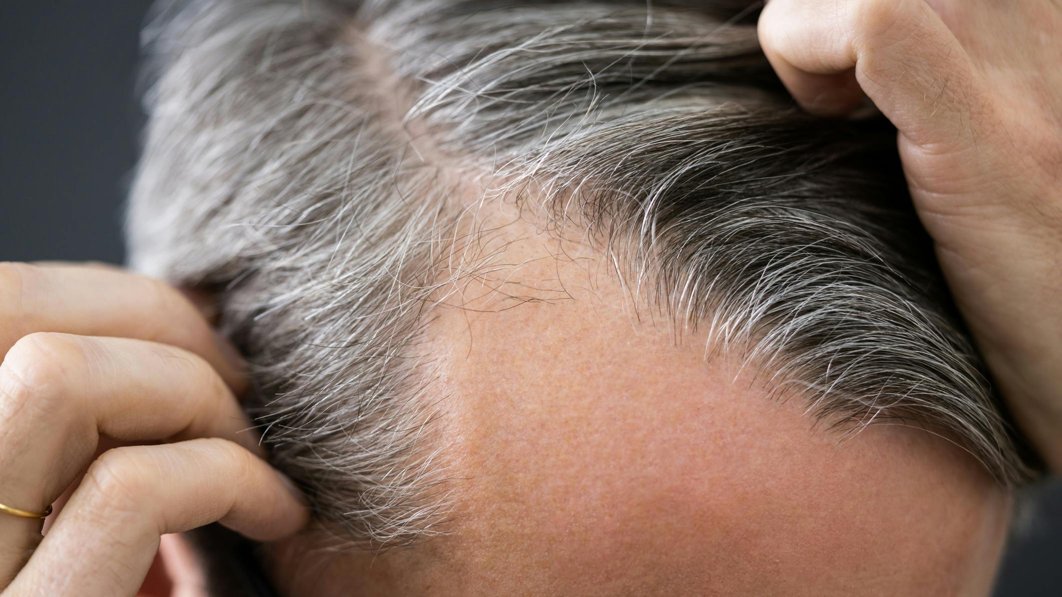 6606ebf03dde36001e6c1914 Dreamstime M 212691620