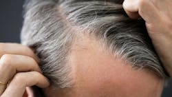 6606ebf03dde36001e6c1914 Dreamstime M 212691620 6606ebf03dde36001e6c1914 Dreamstime M 212691620