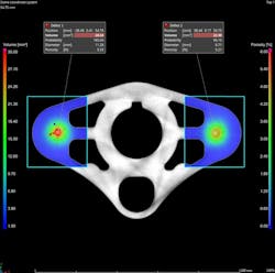 Advanced CT analysis software enables grey-value-based, shape-based, or machine-learning-based segmentation of 3D data. Advanced CT analysis software enables grey-value-based, shape-based, or machine-learning-based segmentation of 3D data.