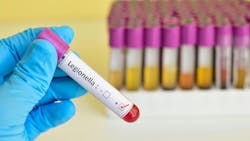 Legionella positive blood sample Legionella positive blood sample